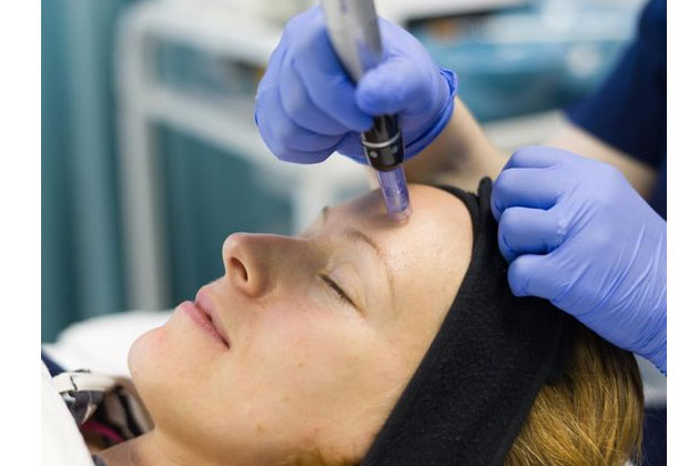 Rejuvenare faciala fara durere cu Dermapen!