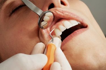 Fractura dentara: tipuri de fracturi, simptome si tratamente